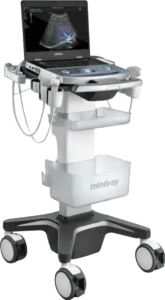 Portable Ultrasound machine Portable Ultrasound machine