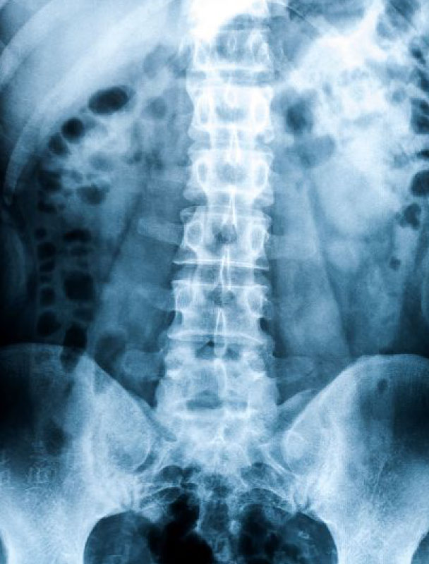 Xray at your location for back injury Xray at your location for back injury