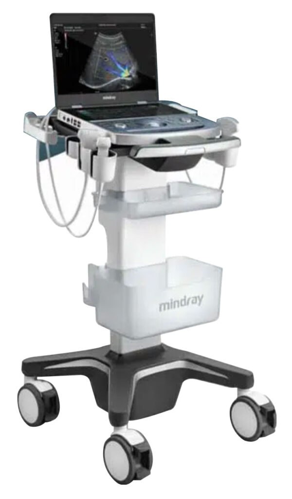 Portable Ultrasound Machine, the Mindray MX7