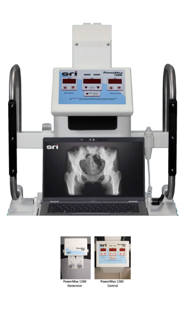 PowerMax 1260, A portable x-ray machine PowerMax 1260, A portable x-ray machine